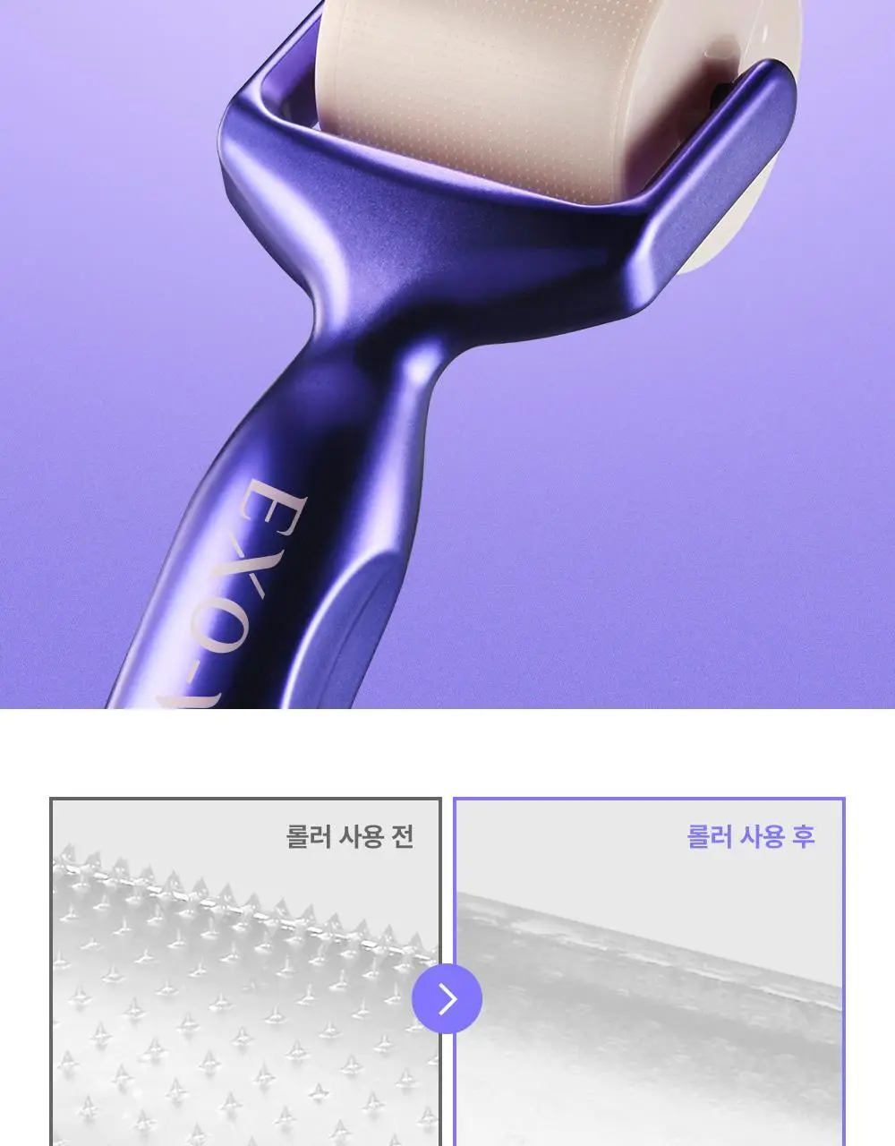 [모공교정] 아이디플라코스메틱 엑소브이 프로리프팅 세트(리프팅 앰플 5ml + MTS 롤러) 상세페이지 27